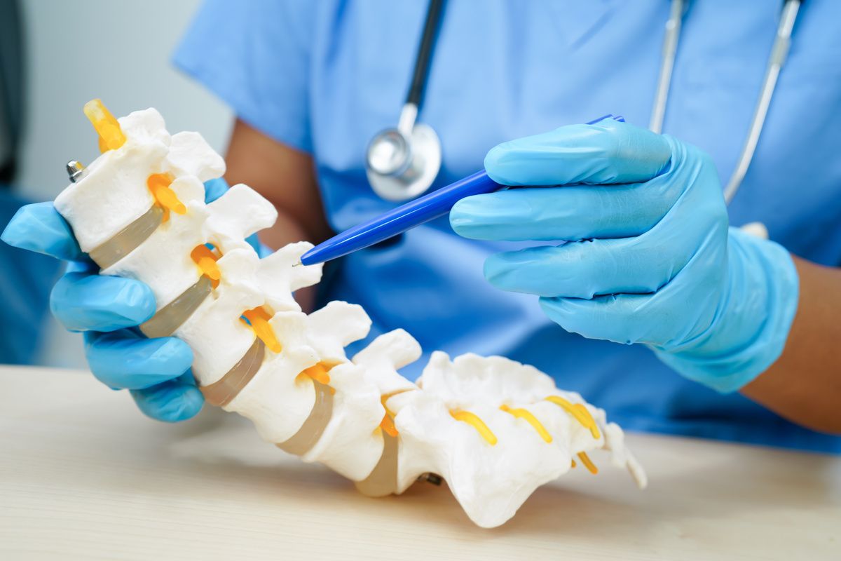 C4 C5 disc herniation