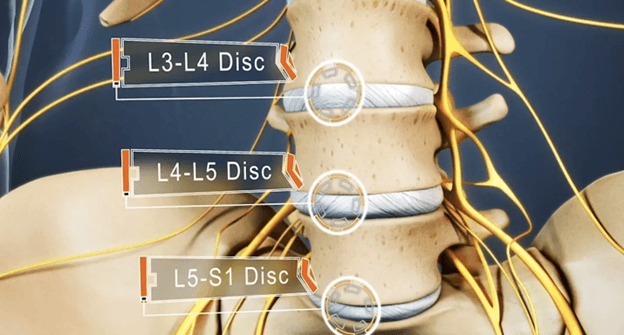 Image showing the l3 through l5 spine vertebrae