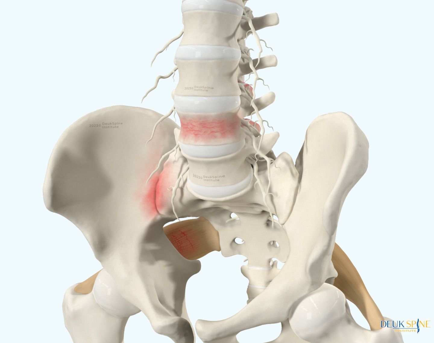 lumbar-back-pain-web-0146.jpg